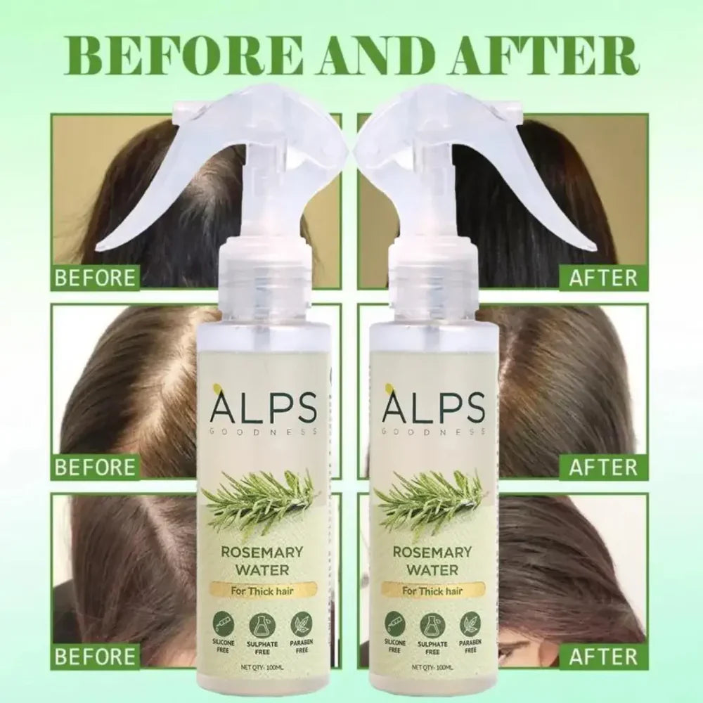 Rosemary Water Spray | For Hair Regrowth (Buy 1 Get 2 Free 😍) Zapiffy.store