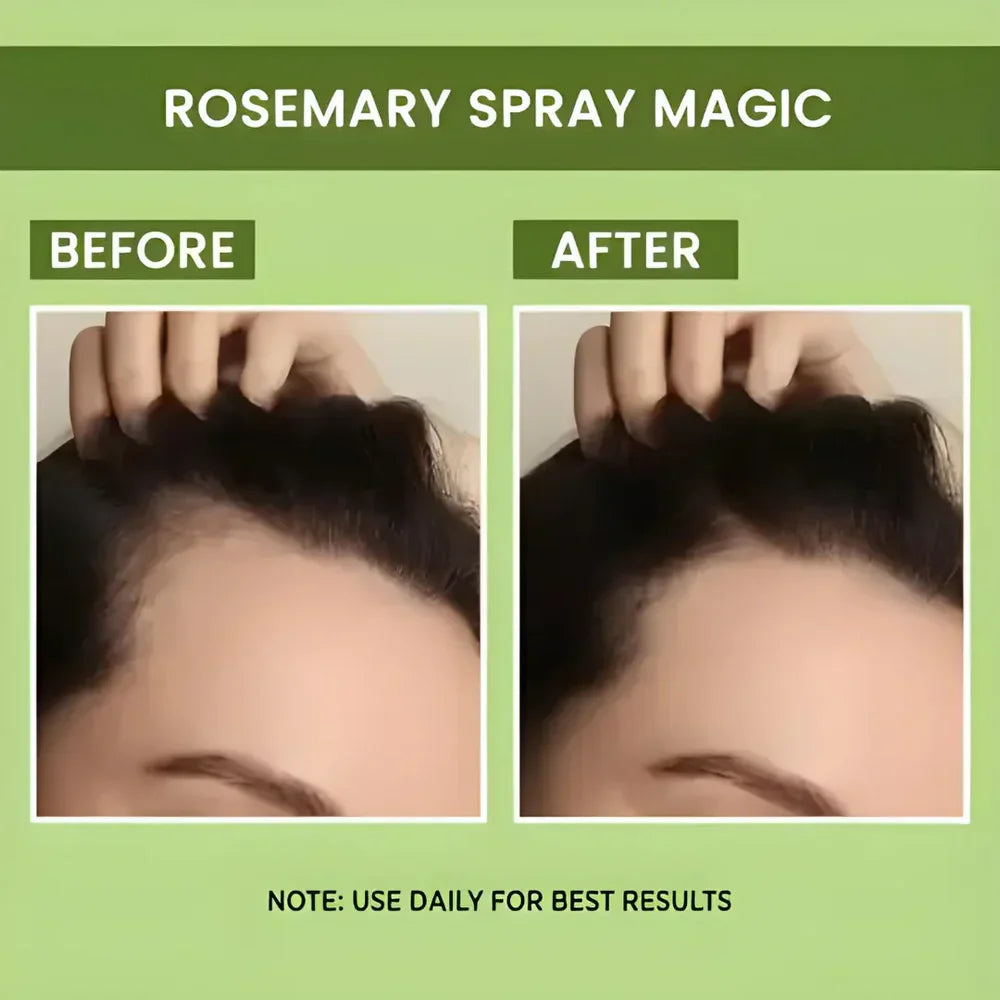 Rosemary Water Spray | For Hair Regrowth (Buy 1 Get 2 Free 😍) Zapiffy.store