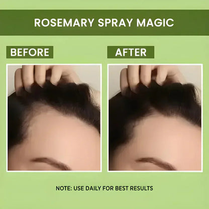 Rosemary Water Spray | For Hair Regrowth (Buy 1 Get 2 Free 😍) Zapiffy.store