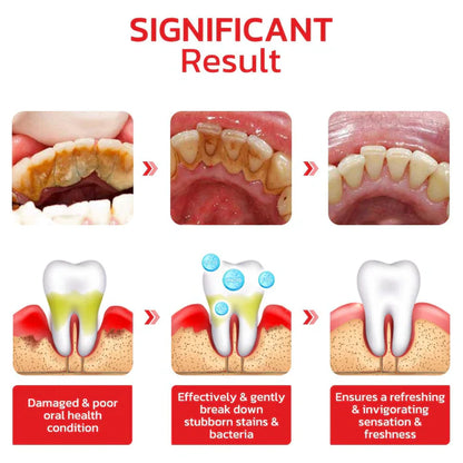 SP4 Ultra Whitening Probiotic Toothpaste gomart.in